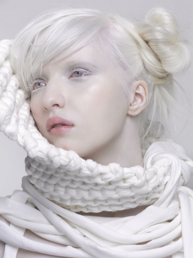 Gadis albino tercantik di dunia, sukses sebagai model