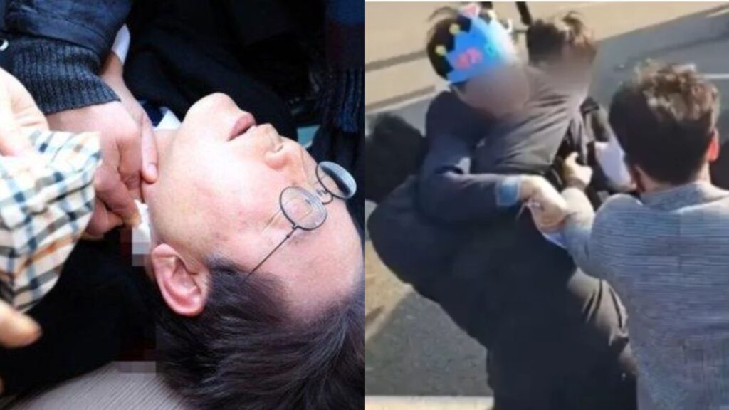 Leher pemimpin pembangkang Korea Selatan cedera akibat ditikam